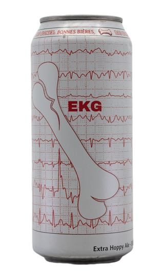 Bad Bones EKG